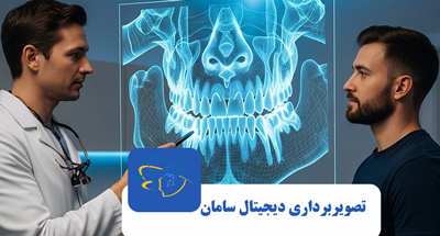 CBCT